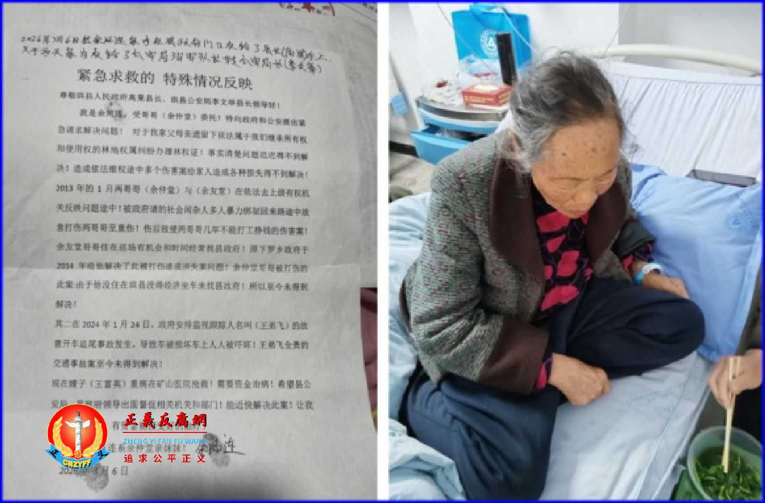 四川省珙县访民余仲堂妻子(右图),于2024年因身体不适由其子开车前往医院途中,被政府雇用来跟监的人追尾造成交通事故,最近因心衰疾病加重无钱治病,向政府紧急求救。.jpg 四川省珙县访民余仲堂妻子(右图),于2024年因身体不适由其子开车前往医院途中,被政府雇用来跟监的人追尾造成交通事故,最近因心衰疾病加重无钱治病,向政府紧急求救。.jpg